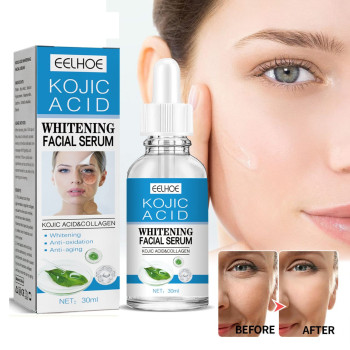 Eelhoe Kojic Acid Anti-Aging Whitening Facial Serum For Dark Spots, Melasma Acne Scars Pigmentation and Brighten Skin Tone - 30ml