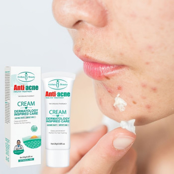 Aichun Beauty Anti Acne Face Cream For Acne And Blemish, Acne Spot and Acne Scars Treatment 20g