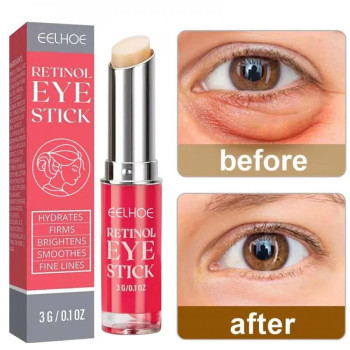 Eelhoe Anti-Wrinkle Retinol Eye Cream Stick Anti Puffiness, Remove Eye Dark Circles, Whitening And Skin Repair Stick - 0.1 Oz (3 g)