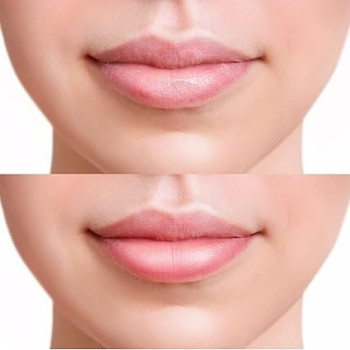 Frudia Blueberry Hydrating Honey Lip Balm Blueberry Extract, 10Ml