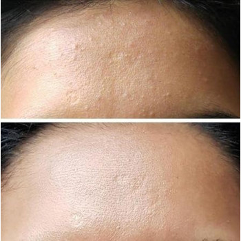 Benton Aloe Bha Skin Toner Calming And Soothing, 200 Ml