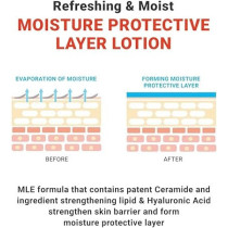 Atopalm Mle Lotion, 48 Hour Long Hydration For All Ages From Babies To Adults With Sensitive Skin, 120 Ml