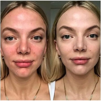 Dr.Jart+ Cicapair Tiger Grass Cream For Skin, Spf22, 50 Ml