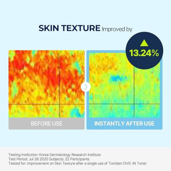 Torriden Dive-In Low Molecular Hyaluronic Acid Toner Low pH Facial Astringent For Hydrating, Exfoliating, Sensitive, Oily Skin, 300 ml
