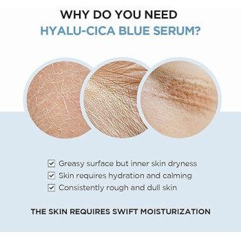 Skin1004 Madagascar Centella Hyalu-Cica, Blue Serum, 50 ml