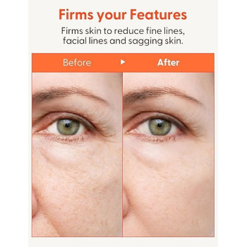 Its Skin Collagen Nutrition Eye Cream For All Skin Type, 25 ml