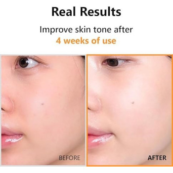 Isntree Hyper Pure Vitamin C 23 Serum Vitamin E, Panthenol For Smooth And Brightens Skin, 20 ml