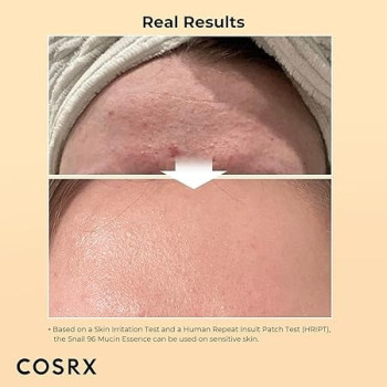 Cosrx Advanced Snail 96 Mucin Power Essence, 100 ml