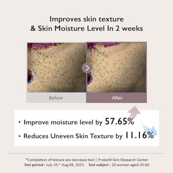 Haruharu Wonder Black rice Hyaluronic Toner Free Of Alcohol And Fragrance For Sensitive Skin, 150 ml