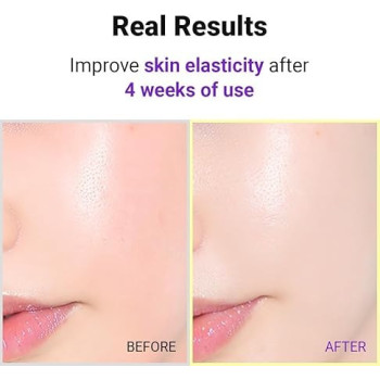 Isntree Hyper Retinol Ex 1.0 Serum Helps Reduce Fine Lines And Skin Firmness, 20 ml