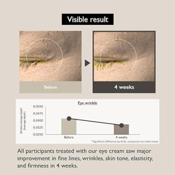 Haruharu Wonder Black Rice Bakuchiol Retinol Alternative, Hydrating Eye Cream, 20 ml