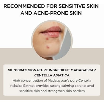 Skin1004 Madagascar Centella Asiatica Ampoule Facial Serum For Soothing Sensitive And Acne-Prone Skin, 55 ml