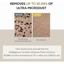 Skin1004 Madagascar Centella Ampoule Foam For Sensitive And Acne Prone Skin, 125 ml