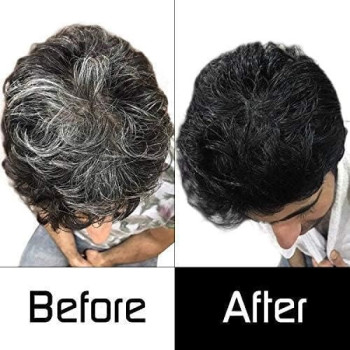 Mokeru Black Hair Shampoo With Ginger Essence, Pack Of 2, 500Ml Each