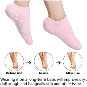 Reusable Silicone Socks And Glove Set For Dry Cracked Skin, Pink