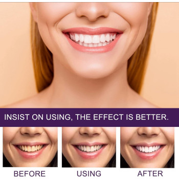 Songqee Teeth Whitening Toothpaste, Whitening Stain Removal Brightening Booster