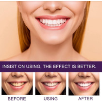Songqee Teeth Whitening Toothpaste, Whitening Stain Removal Brightening Booster