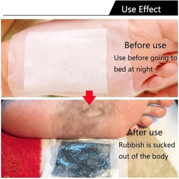 Veabest Cleansing Foot Pads Relief Stress Ginger Improve Sleep And Suitable, 100 Pieces