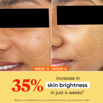 Dot & Key Face Moisturizer Cream With Vitamin C And E, Hydrating and Brightening Skin, 60ml