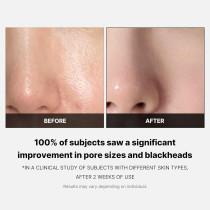 Medicube Zero Pore Pad 2.0 (70 Pads)