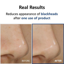 Isntree Hyper Acid 4 (AHA BHA PHA LHA) 30 Serum, 20Ml