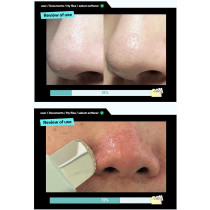 ilso Super Melting Sebum Softener, 150Ml