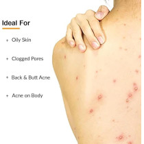 Fixderma Salicylic Acid Salyzap Body Wash For Acne, 200 Ml