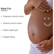 Fixderma Pregnancy Stretch Marks Cream, 75 g