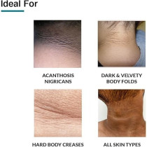 Fixderma Nigrifix Cream For Acanthosis Nigricans, Underarm Cream Effective For Armpit, Knees, Elbows And Knuckles, Dermatologist Tested, 100G