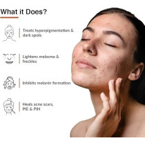 Fixderma 10Percentage Tranexamic Acid Plus 2Percentage Kojic Acid Plus 1Percentage Arbutin Skarfix -Tx Face Cream, Pigmentation Removal Cream, Uneven Skin Tone, Reduces Dark Spots And Blemishes, 15 Gm