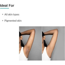 Fixderma Nigrifix Underarm Lightening Roll On With 6Percentage Aha, Lactic Acid And 1Percentage Mandelic Acid And Kojic Acid, Brightens Skin And Exfoliates Underarm, For Sensitive Skin, 120Ml (Pack Of 2)