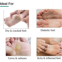 Fixderma Foobetik Cream, Foot Cream, Foot Care For Diabetic, For Dry And Cracked Feet, Moisturizes And Soothes Feet, Heel Repair, For Calloused Or Chapped Skin, Paraben Free, 50G