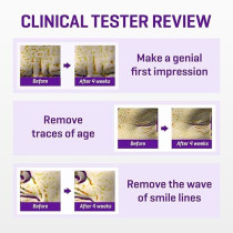 Some By Mi Retinol Intense Advanced Triple Action Eye Cream, 30ml