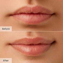 CNP Honey Lip Butter, Hydrating Overnight Manuka Lip Balm And Mask, (0.5 Fl.Oz / 15Ml)