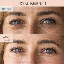 Beauty of Joseon Revive Eye Serum: Ginseng + Retinal ,30ml
