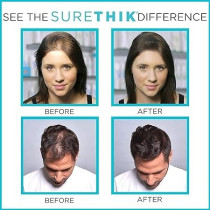 SureThik Hair Thickening Fibers, Dark Brown, 30 g