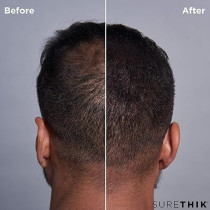 Surethik Hair Building Fibers- Conceal Hair Loss, Thinning Hair And Balding Spots Instantly With Natural Thickening Keratin Protein Fibers, 15 G, Light Brown