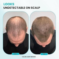 SURETHIK Hair Fibers For Thinning Hair, Building Hair Fibers To Conceal Thinning Hair, Instantly Fuller Looking Hair for Men And Women, Light Brown, 30g, Light Brown