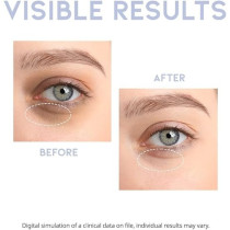 OOTD Vegan Eye Serum With Hyaluronic Acid, Vitamin C, Caffeine, Dark Circle Under Eye Treatment, 30 G