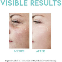 Ootd Wrinkle Lift Retinol Serum, 50Ml