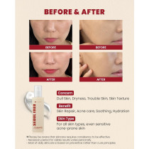 Ksecret Seoul 1988 Essence Snail Mucin 97% Plus Rice, 100Ml