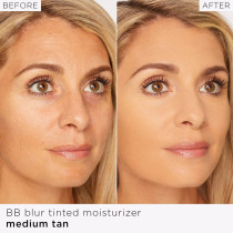 Tarte Bb Blur Tinted Moisturizer, Medium-Tan