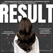 Acm Novophane Anti Hair Loss Lotion 100 Ml