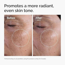 The Ordinary Glycolic Acid 7% Exfoliating Toner 100ml