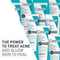 CeraVe Acne Foaming Cream Cleanser, 5 Fl Oz (Pack of 1)