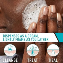 CeraVe Acne Foaming Cream Cleanser, 5 Fl Oz (Pack of 1)