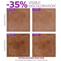 La Roche Posay Pure Niacinamida 10 Serum Concentre Anti-Taches 30 Ml