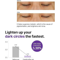 Some By Mi Retinol Intense Advanced Triple Action Eye Cream 30ml Mild Overnight Korean Anti-Aging Eye Cream for Dark Circles And Fine Lines Ideal for Retinol Beginners