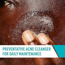Cerave Face Wash Acne Treatment Salicylic Acid Cleanser with Purifying Clay for Oily Skin Blackhead Remover and Clogged Pore Control 8 Ounce