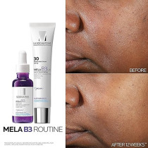 La Roche-Posay Mela B3 Serum, Dark Spot Corrector With Anti-Aging Melasyl + 10% Niacinamide, Discoloration Correcting Serum for Sun Spots, Age Spots & Post-Acne Marks, Long-Lasting Results, 30ML